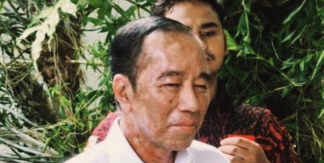 Dokter Tifa: Sakit Kulit Jokowi Akibat Stres Berat