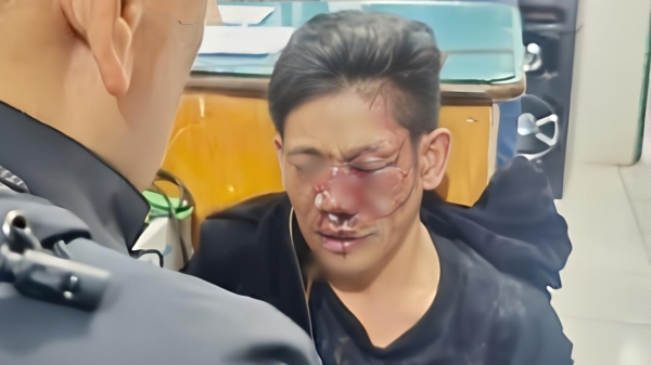 Sembunyi di Gubuk, Pembacok Anggota TNI Berhasil Ditangkap: Wajahnya Begini Usai Dapat Salam Olahraga!