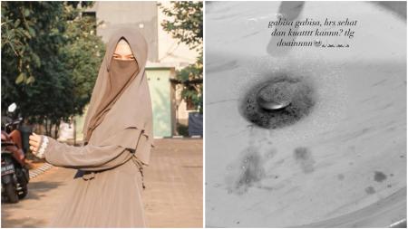 Wastafel Berdarah Wardatina Mawa: Bukti Stres Akibat Selingkuh Insanul Fahmi & Inara Rusli?