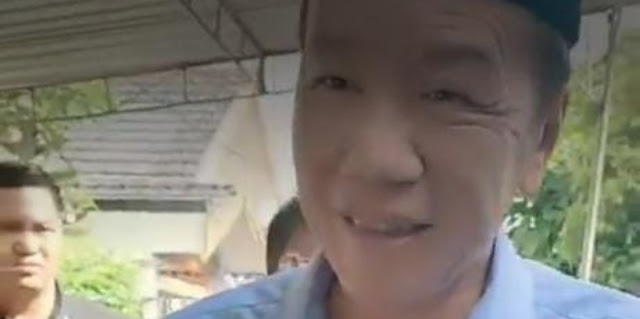 Kesehatan Jokowi Dipertanyakan: Dokter Ungkap Tanda-Tanda yang Butuh Perawatan Super Intensif