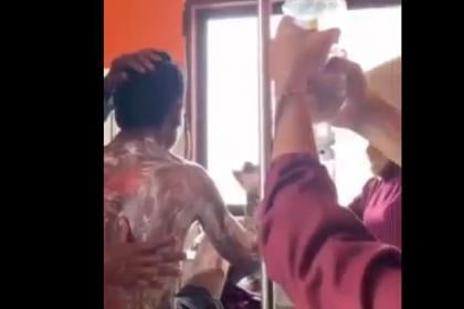 Mengerikan! Ibu di Sumbawa Bakar Anak Kandung Hanya Karena Tolak Cari Rumput, Ini Kronologinya